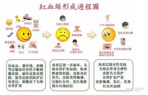皮肤色素斑，成因、类型与应对策略