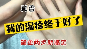 西安肤康皮肤病专科医院，专业守护皮肤健康
