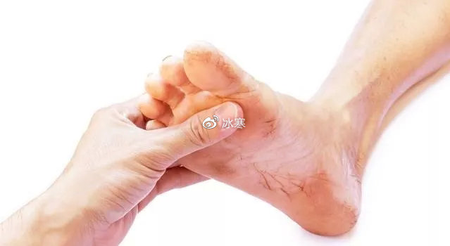 脚上皮肤瘙痒，原因、预防与应对策略