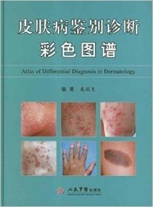 常见皮肤病图谱，识别与应对的全面指南
