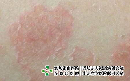 第175页