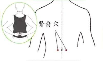 鱼鳞皮肤，科学方法与自然疗法的双重解密