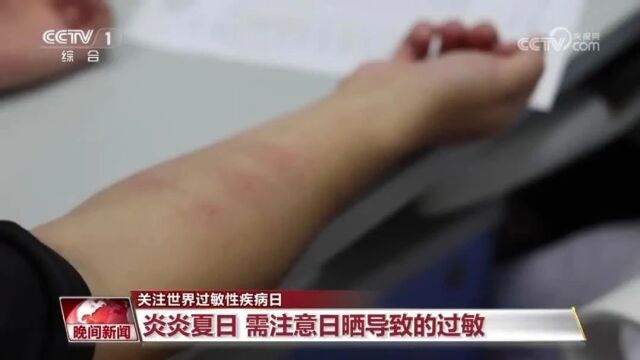 皮肤过敏红肿痒，选择合适药膏的指南