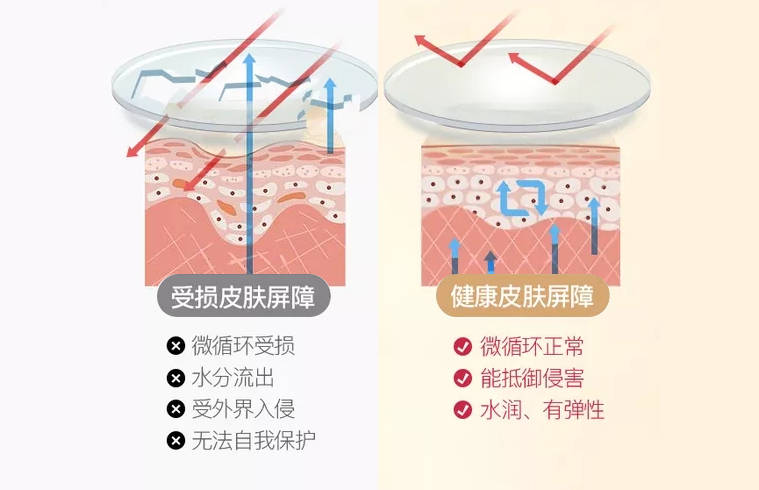 皮肤病图片及对应名字，认识与理解皮肤健康的重要一课