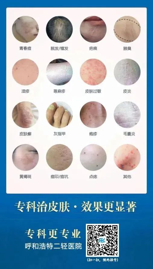 皮肤病，种类繁多，痒痛难耐的真相