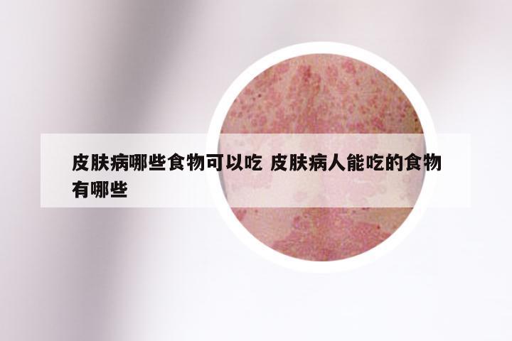 皮肤病患者的饮食禁忌与注意事项