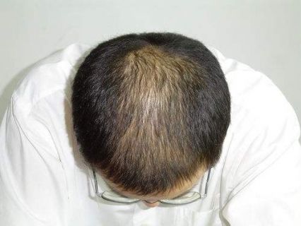 揭秘导致头发变白的原因，从生理到环境的全面解析