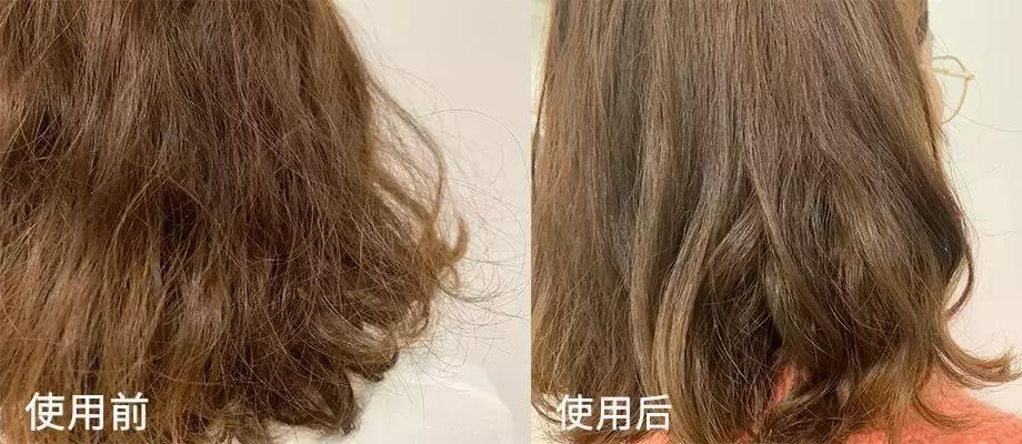 头发爱出油导致脱发？科学应对策略大揭秘