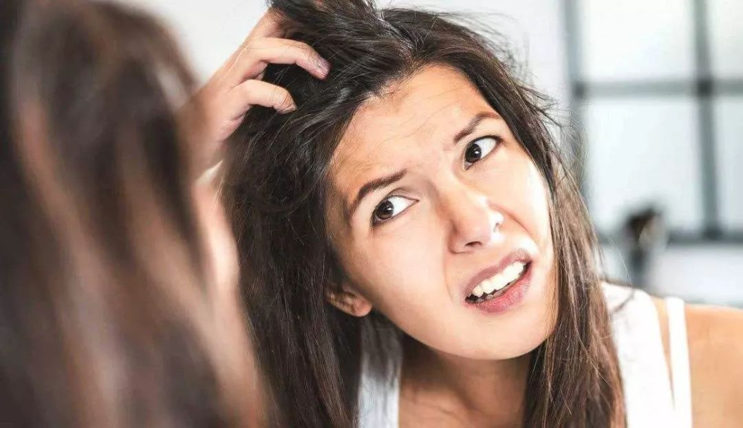 头发出油厉害怎么办？还掉头发？—— 科学应对策略与日常护理指南