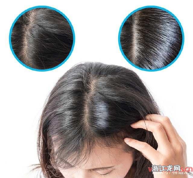 打造浓密粗发，揭秘让头发变粗的秘诀