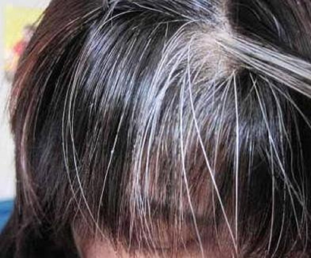 头发变白后能否再次变黑，以及是否还能继续生长？