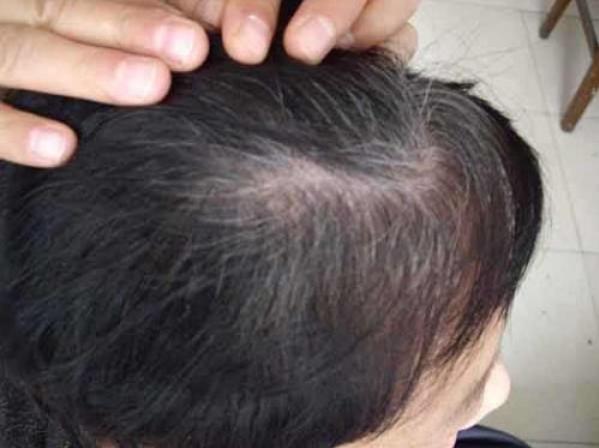 头发颜色与头发含铜关系的科学探索