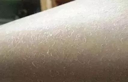 身体皮肤干燥起皮屑的应对策略，从日常护理到专业治疗