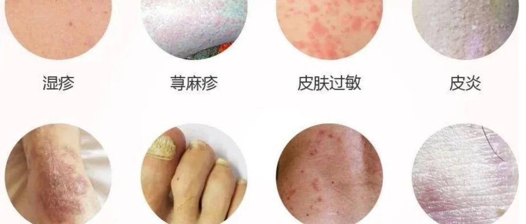 皮肤病100种对照图解，解锁肌肤健康的秘密