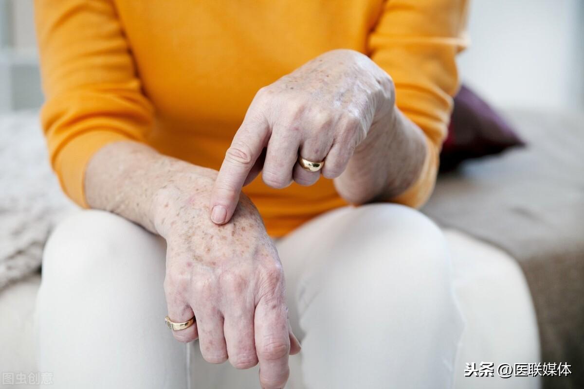 皮肤椭圆形红色斑疹，成因、诊断与治疗