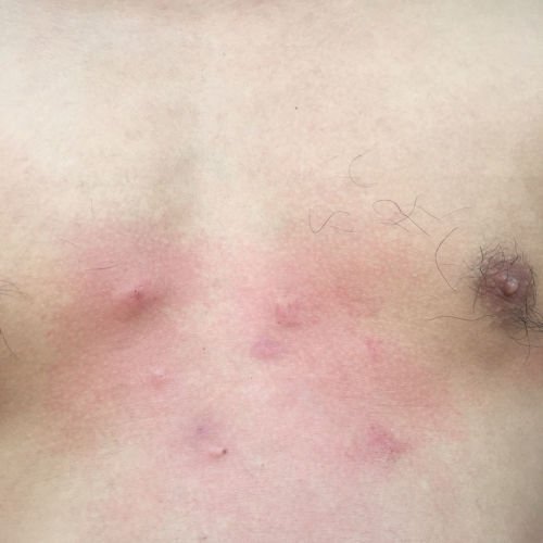 第1147页