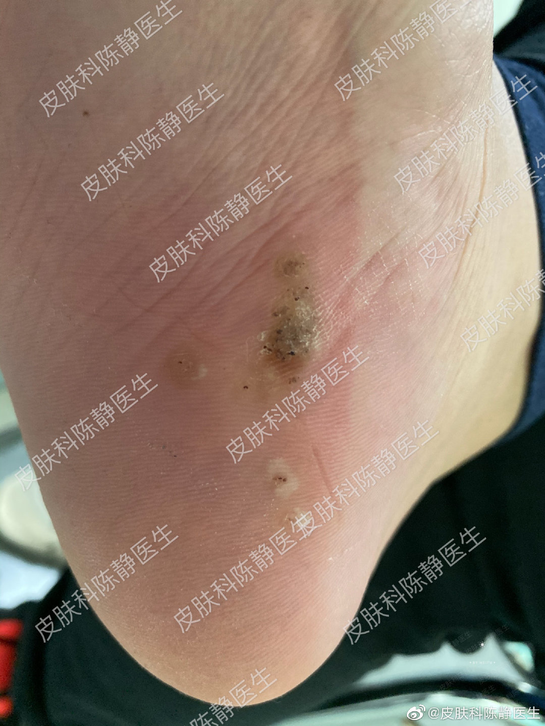 第1141页