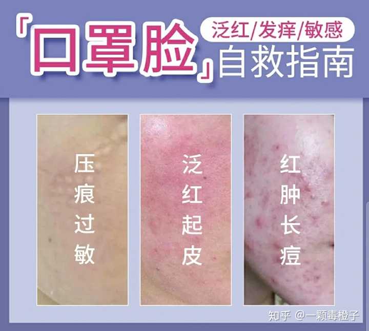 皮肤过敏与红疙瘩，了解、预防与应对策略
