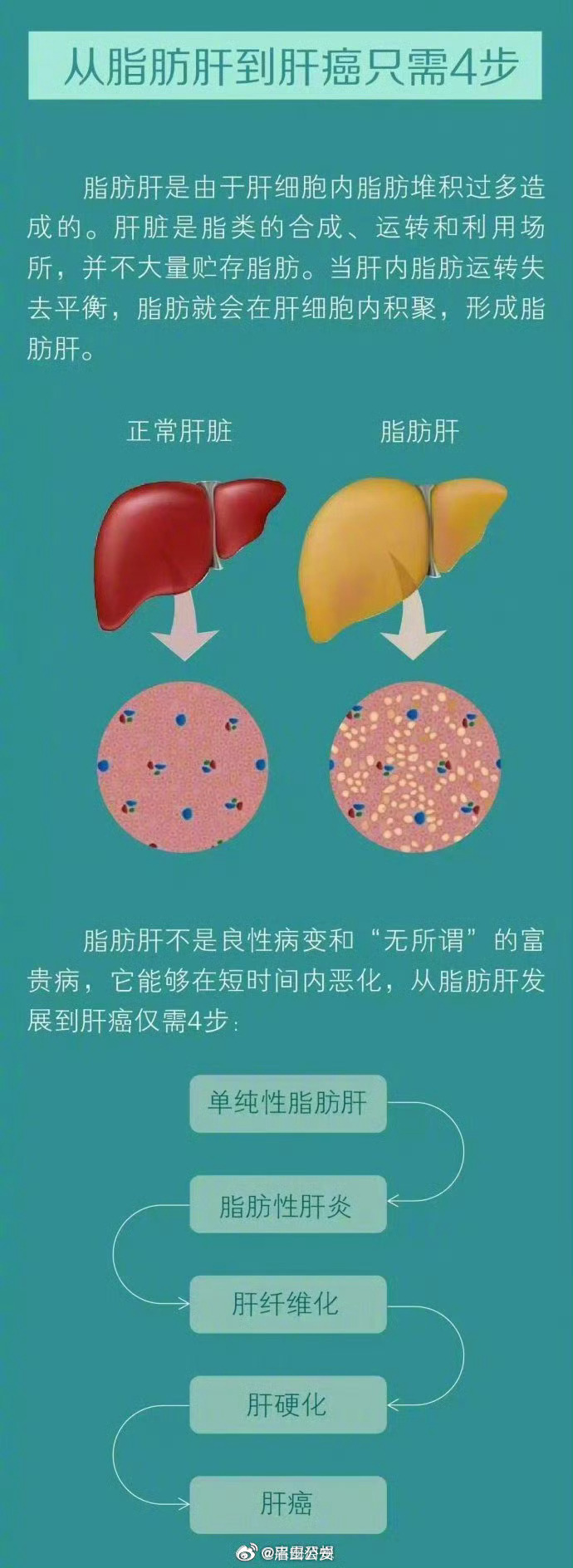 肝脏的奥秘，一张图片背后的故事