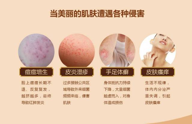 皮肤抓痒导致溃烂的应对策略，选择合适药膏的指南