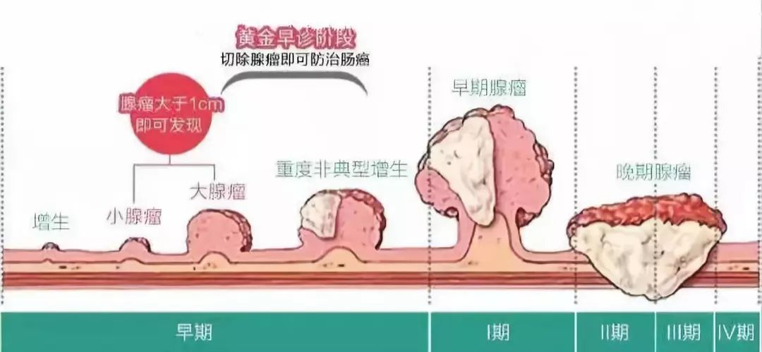 肠胃型感冒，症状解析与治疗指南