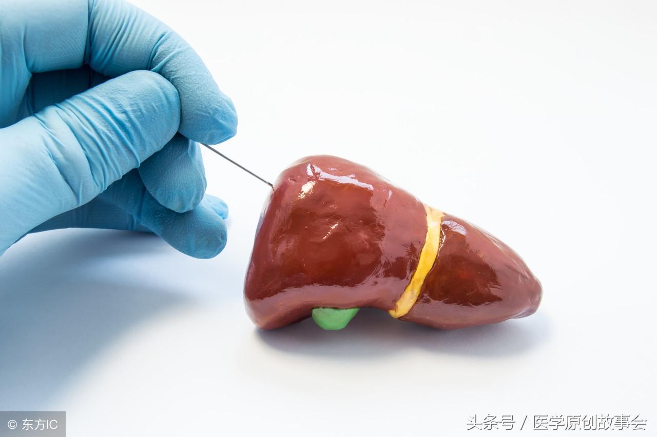 肝脏不好，症状、治疗与饮食调养全解析