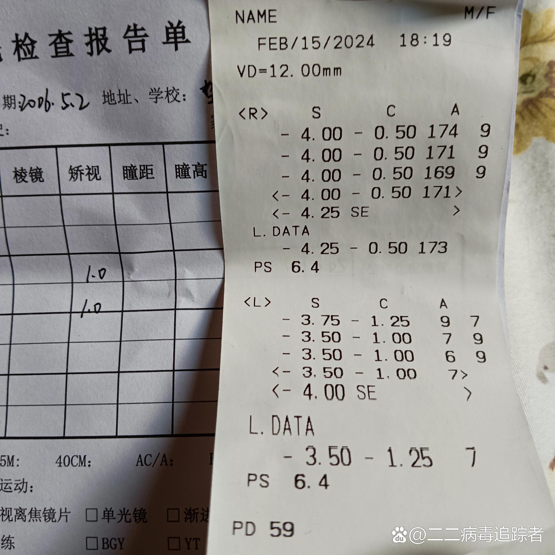 验光服务价格解析，北京医院验光一般多少钱？